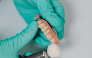 Dentadura postiza: ¿qué tipos hay? - Clínica dental Madrid | Dental Corbella